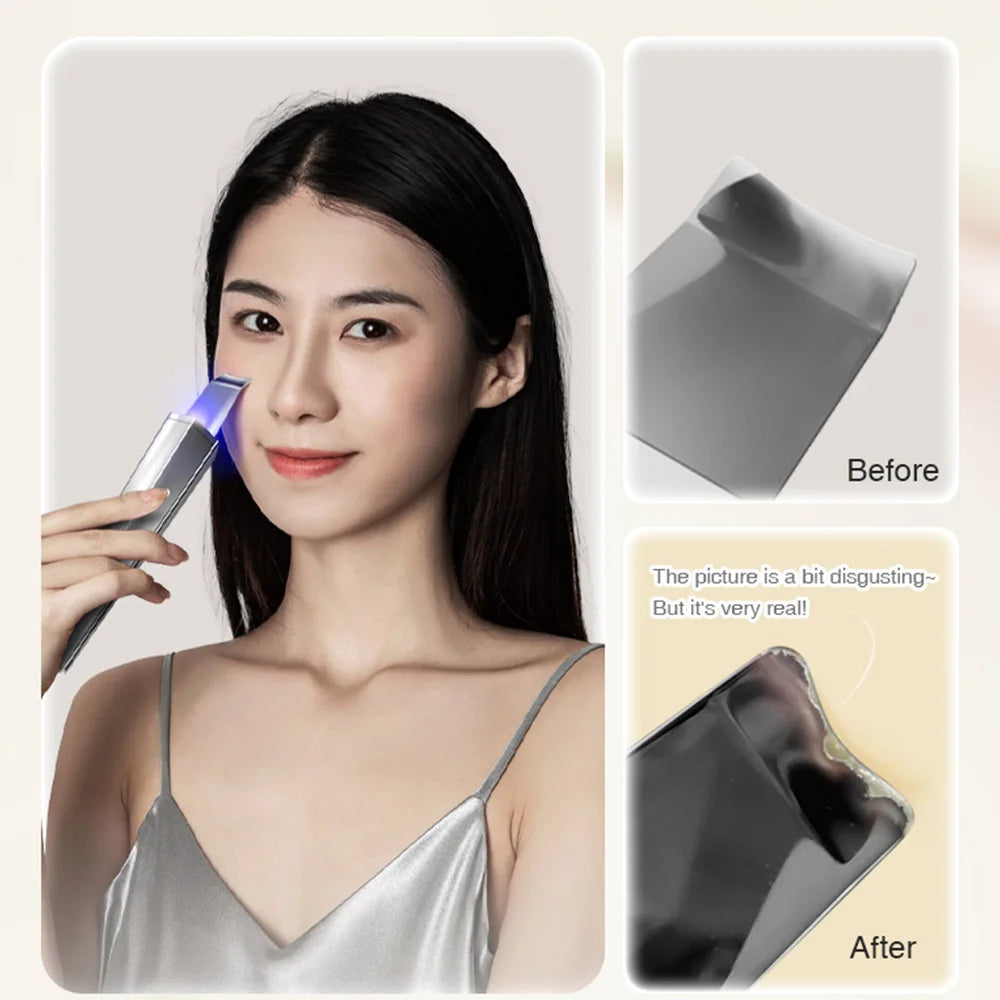 Marbendi 2-in-1 Face Massager and Ultrasonic Scrubber