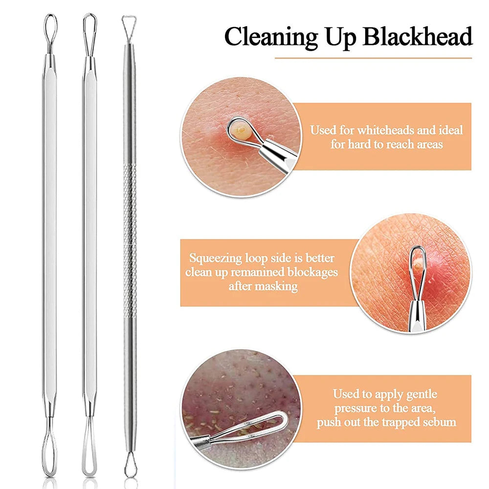 Marbendi 8-Piece Blackhead Remover Tool Kit for Clear Skin