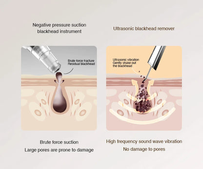 Marbendi 2-in-1 Face Massager and Ultrasonic Scrubber