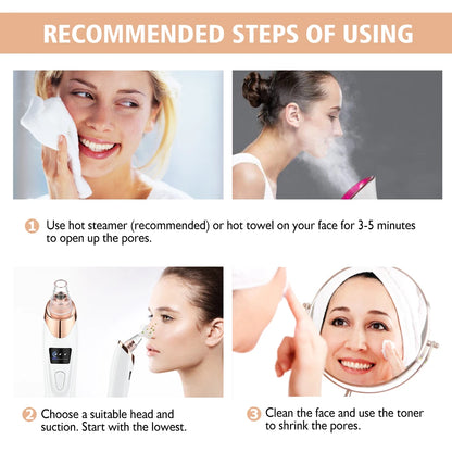 Marbendi Electric Blackhead Remover for Clear Skin Care