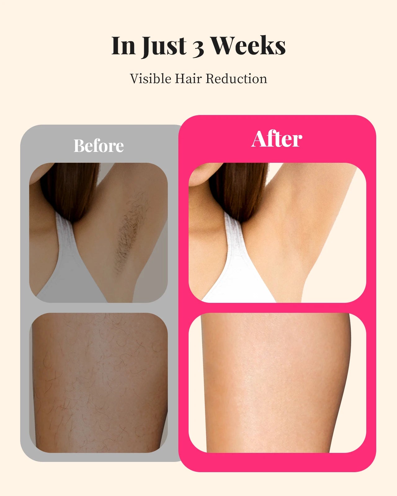 Marbendi IPL Hair Removal Device for Smooth Skin Care